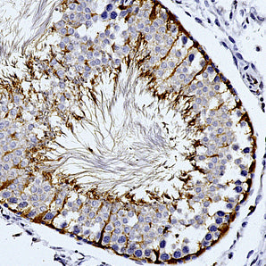 Mouse Monoclonal Antibody to Phosphoprotein Enriched in Astrocytes (PEA-15), Cat# MCA-4D117
