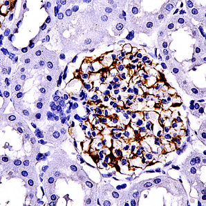 Mouse Monoclonal Antibody to Nestin, Cat# MCA-4D11