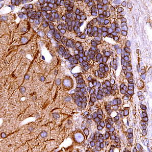 Mouse Monoclonal Antibody to β-Tubulin, Cat# MCA-4E4