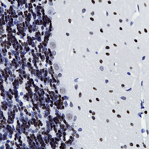 Mouse Monoclonal Antibody to Methyl-CpG Binding Protein 2 (MeCP2), Cat# MCA-4F11