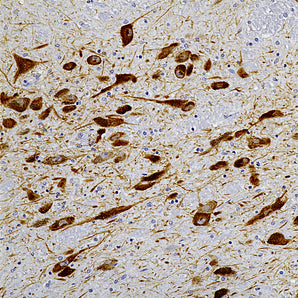 Mouse Monoclonal Antibody to Tyrosine Hydroxylase (TH), Cat# MCA-4H2