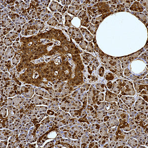 Mouse Monoclonal Antibody to Parkinsonism Associated Deglycase (DJ1/Park7), Cat# MCA-4H4