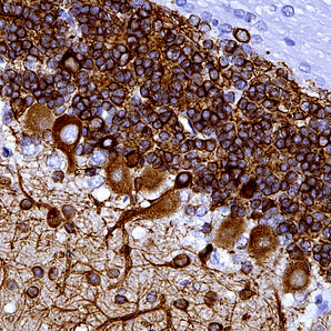 Mouse Monoclonal Antibody to Microtubule Associated Protein MAP2AB (MAP2), Cat# MCA-4H5