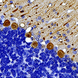 Mouse Monoclonal Antibody to Calbindin, Cat# MCA-4H7