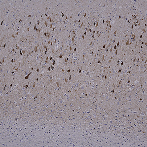 Mouse Monoclonal Antibody to Microtubule Associated Protein Tau, MAP-τ (Tau), Cat# MCA-5B10