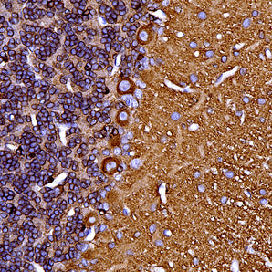 Mouse Monoclonal Antibody to Microtubule Associated Protein Tau, MAP-τ (Tau), Cat# MCA-5B10