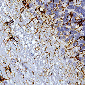 Mouse Monoclonal Antibody to Glial Fibrillary Acidic Protein (GFAP), Cat# MCA-5C10
