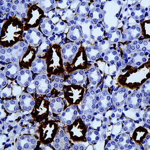 Mouse Monoclonal Antibody to Galectin-3, Cat# MCA-5C21