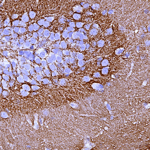 Mouse Monoclonal Antibody to Growth Associated Protein 43 (GAP43), Cat# MCA-5E8