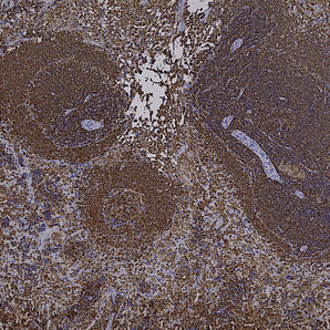 Mouse Monoclonal Antibody to L-Plastin Cat# MCA-5F101