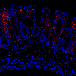 Mouse Monoclonal Antibody to L-Plastin Cat# MCA-5F101