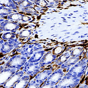 Mouse Monoclonal Antibody to L-Plastin, Cat# MCA-5F101