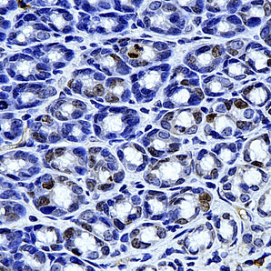 Mouse Monoclonal Antibody to Ki67-Rodent (Ki-67), Cat# MCA-5F86