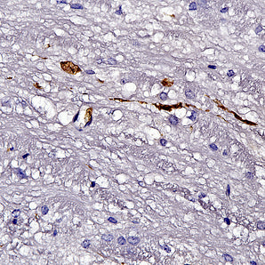 Mouse Monoclonal Antibody to Neurofilament NF-L (Nfl, NEFL) DegenoTag&trade; Peptide, Cat# MCA-5H112