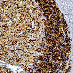Mouse Monoclonal Antibody to Microtubule Associated Protein MAP2AB (MAP2), Cat# MCA-5H11