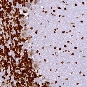 Mouse Monoclonal Antibody to Methyl-CpG Binding Protein 2 (MeCP2), Cat# MCA-5H12