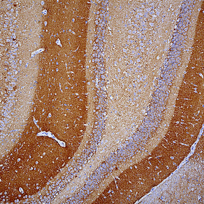 Mouse Monoclonal Antibody to β-Synuclein, Cat# MCA-6A10