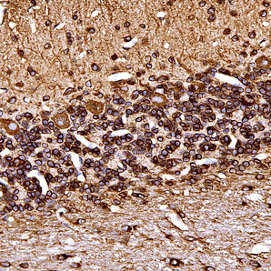 Mouse Monoclonal Antibody to Calreticulin, Cat# MCA-6C6