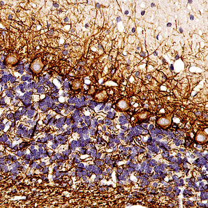 Mouse Monoclonal Antibody to Neurofilament NF-L (Nfl, NEFL), Cat# MCA-6H112