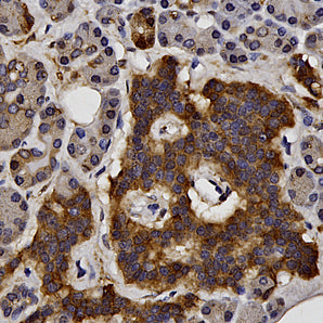 Mouse Monoclonal Antibody to Heat Shock Protein 27 (HSP27), Cat# MCA-6H11