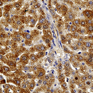 Mouse Monoclonal Antibody to Catalase, Cat# MCA-6H14