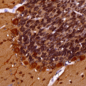 Mouse Monoclonal Antibody to Ubiquilin 2, Cat# MCA-6H9