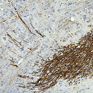 Mouse Monoclonal Antibody to Peripherin, Cat# MCA-7C5