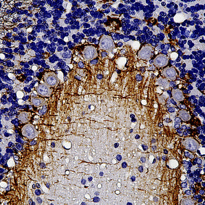 Mouse Monoclonal Antibody to Neurofilament NF-L (Nfl, NEFL), Cat# MCA-7D1