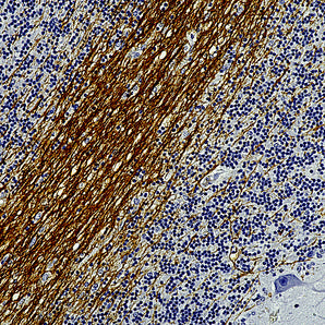 Mouse Monoclonal Antibody to Myelin Basic Protein (MBP), Cat# MCA-7D2