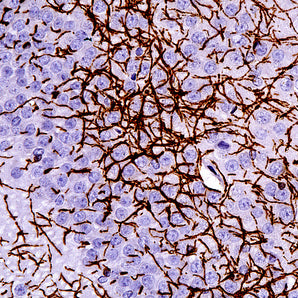 Mouse Monoclonal Antibody to Myelin Basic Protein (MBP), Cat# MCA-7G7