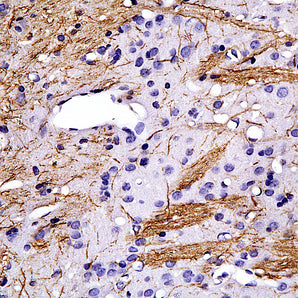 Mouse Monoclonal Antibody to Peripherin, Cat# MCA-8G2