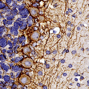 Mouse Monoclonal Antibody to Neurofilament NF-H (Nfh, NEFH), Cat# MCA-9B12