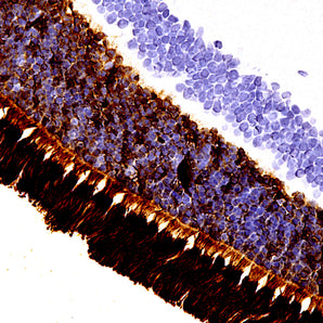 Mouse Monoclonal Antibody to Rhodopsin, Cat# MCA-B630