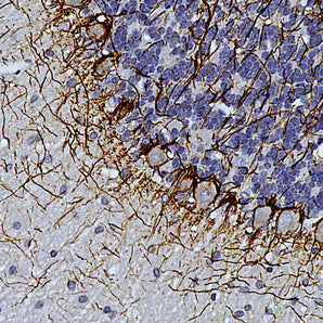 Mouse Monoclonal Antibody to Neurofilament NF-H  (Nfh, NEFH), Cat# MCA-AH1