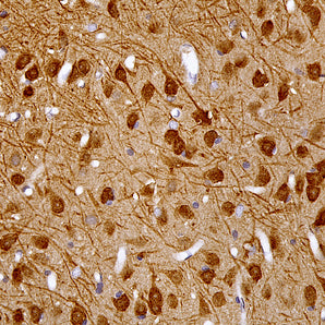 Mouse Monoclonal Antibody to Ubiquitin C-Terminal Hydroxylase L1 (UCHL1), Cat# MCA-BH7