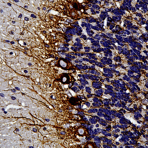 Mouse Monoclonal Antibody to Neurofilament NF-L (Nfl, NEFL), Cat# MCA-DA2