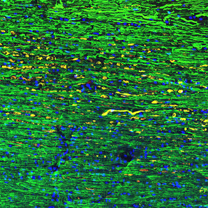 Mouse Monoclonal Antibody to Neurofilament NF-H (Nfh, NEFH) Cat# MCA-NAP4