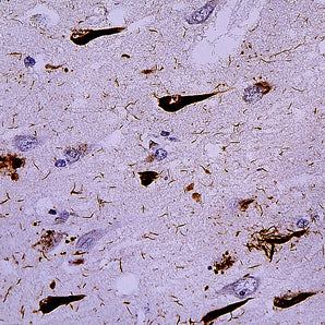 Mouse Monoclonal Antibody to Ubiquitin, Cat# MCA-Ubi-1