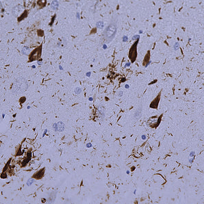 Mouse Monoclonal Antibody to Ubiquitin Cat# MCA-Ubi-1