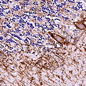Mouse Monoclonal Antibody to Neurofilament NF-H (Nfh, NEFH), Cat# MCA-NAP4