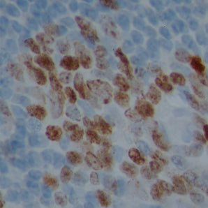 Mouse Monoclonal Antibody to Ki67-Human (Ki-67), Cat#  MCA-6B4