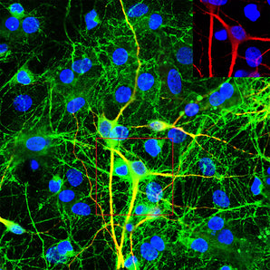 Mouse Monoclonal Antibody to Phospho-MAP-&tau;-Tp205 (phospho-MAPT T205), Cat# MCA-1H103