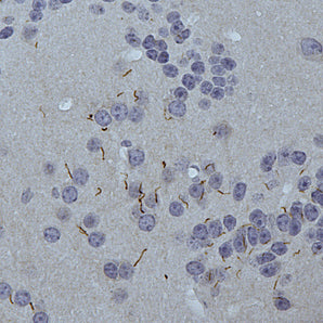 Rabbit Polyclonal Antibody to Adenylate Cyclase III Cat# RPCA-ACIII