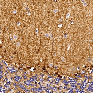 Rabbit Polyclonal Antibody to Aldehyde Dehydrogenase 1 Family Member L1 (ALDH1L1), Cat# RPCA-ALDH1L1