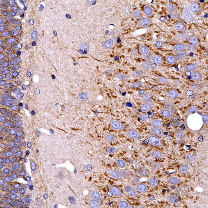 Rabbit Polyclonal Antibody to Ankyrin 3/Ankyrin G,  Cat# RPCA-ANK3