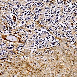 Rabbit Polyclonal Antibody to Annexin A5, Cat# RPCA-ANXA5