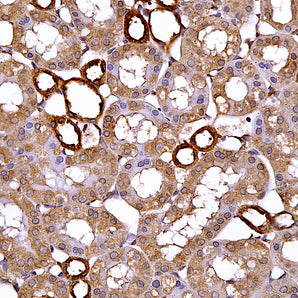 Rabbit Polyclonal Antibody to Annexin A6, Cat# RPCA-ANXA6