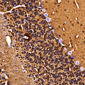 Rabbit Polyclonal Antibody to β-synuclein, Cat# RPCA-SNCB