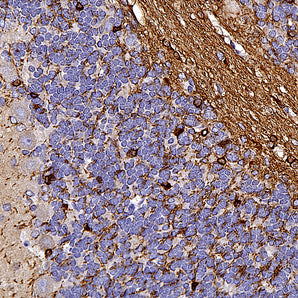 Rabbit Polyclonal Antibody to CNP, Cat# RPCA-CNP