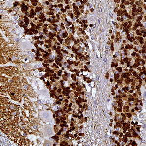 Rabbit Polyclonal Antibody to Calretinin, Cat# RPCA-Calret